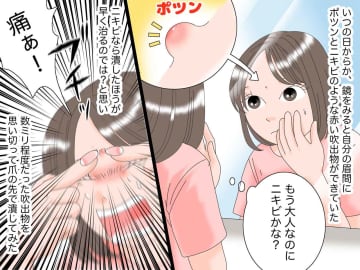 これは私が体験した「自己判断はダメ」という教訓話です。眉間にポツンとできた小さな吹出物を潰した結果、...